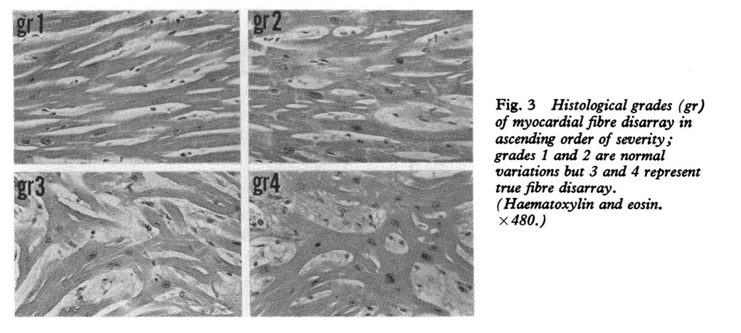 <figure 1>